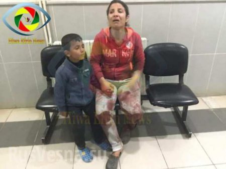 Кровавая ночь в Африне: после турецкого обстрела убиты и ранены дети, в больнице идут операции (ФОТО, ВИДЕО 18+)